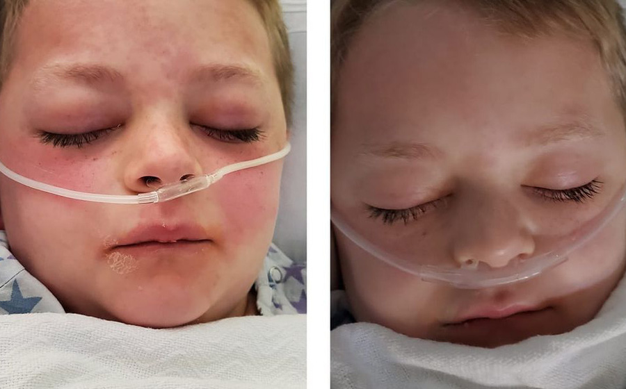 Phát hiện các biến chứng viêm đa hệ thống ở hàng loạt trẻ em Ấn Độ sau khi nhiễm Covid-19 - Ảnh 1