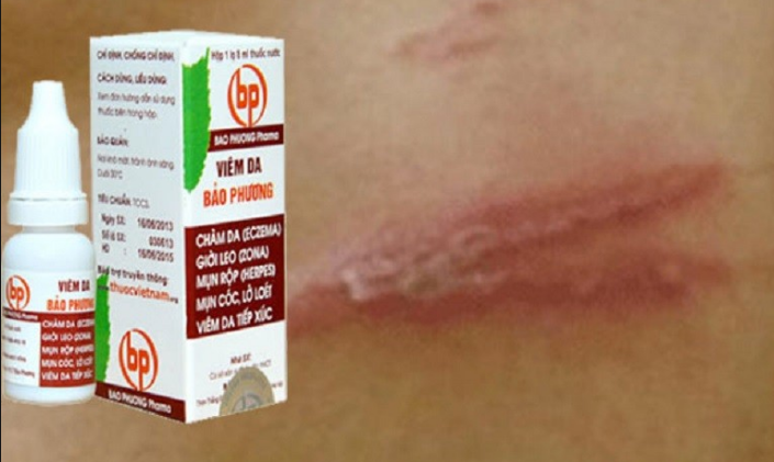 &nbsp;Thu hồi thuốc vi&ecirc;m da Bảo Phương do kh&ocirc;ng đạt chuẩn chất lượng