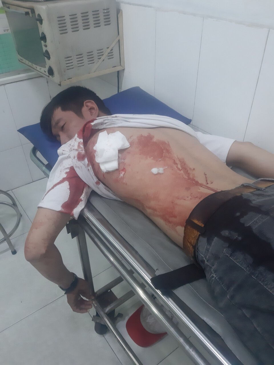 Một nh&#226;n vi&#234;n của c&#244;ng ty t&#224;i ch&#237;nh bị tấn c&#244;ng khi thu hồi nợ tại nh&#224; kh&#225;ch h&#224;ng - Ảnh 1