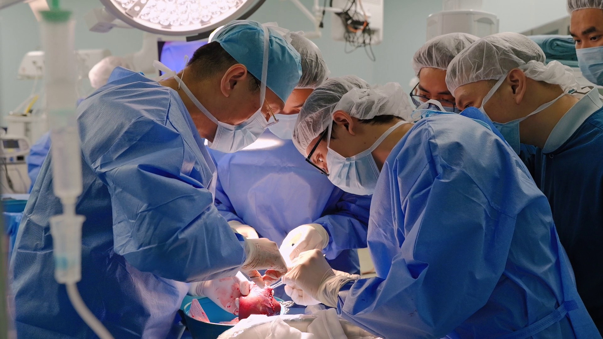 PGS.TS.BS L&ecirc; Văn Th&agrave;nh c&ugrave;ng &ecirc;-k&iacute;p đang tinh chỉnh lại mảnh gan hiến từ người mẹ trước khi gh&eacute;p cho b&eacute;.